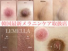 デミーナボーテ(DemynaBeaute)