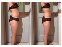 ヨサパーク アカーシャ(YOSA PARK AKASHA)/ぽっこりお腹のお悩み