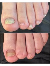 ケアプラス(care plus)/フットネイルケア