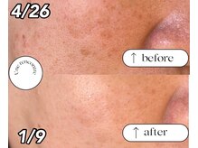 ユヌランコント 岐阜店(Une rencontre)/エンビロン×シミケア