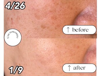 ユヌランコント 岐阜店(Une rencontre)/エンビロン×シミケア