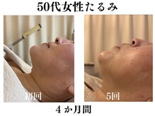 ランティル(l’until)の雰囲気（小顔・たるみ・毛穴悩みを改善。鏡を見るのが楽しみになる毎日に）