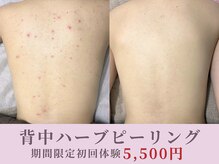ホリホック