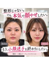 ドクターマジックタッチ(Dr.MAGIC TOUCH)&nbsp;最強 小顔術