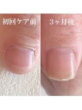 ミラ(Mila)/爪を育てるネイルケア