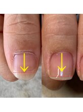 イル(iLL)/Nail care ～自爪を強く美しく～