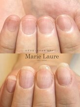 マリーロール 梅田店(Marie Laure)/深爪矯正/自爪育成/自爪風