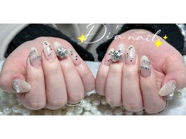 持ち込み/パラジェル/フィルイン