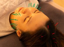 ゴート 豊田店(GOAT)/美容鍼