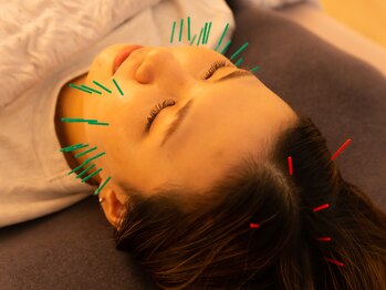 ゴート 豊田店(GOAT)/美容鍼