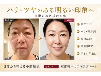 サロンチオリ 烏丸(Salon Chiori)の写真/40代からのハリ不足・疲れ顔へ。筋膜まで届く独自アプローチで、眠っていた肌本来の輝きを引き出す。