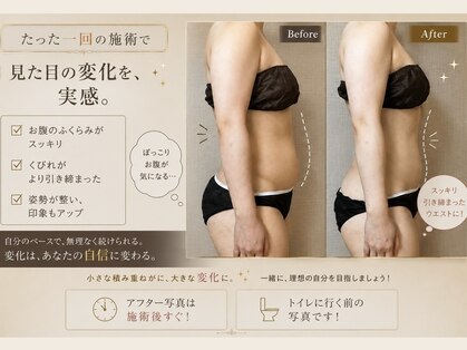 サハスラーラ(SAHASRARA)の写真
