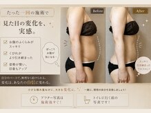 サハスラーラ(SAHASRARA)