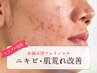 ニキビ・肌荒れ改善フェイシャル　￥8,800
