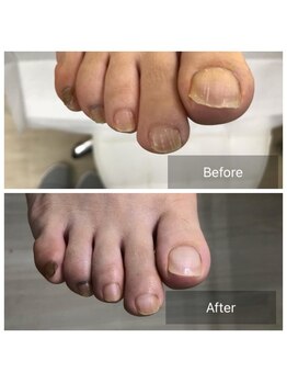 ドクターネイル爪革命 北千住店/トータルフットケア