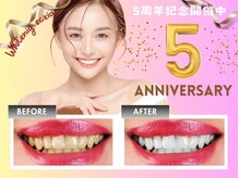 セルフホワイトニングサロン　エクシアホワイトニング西宮北口店【7/15OPEN（予定）】