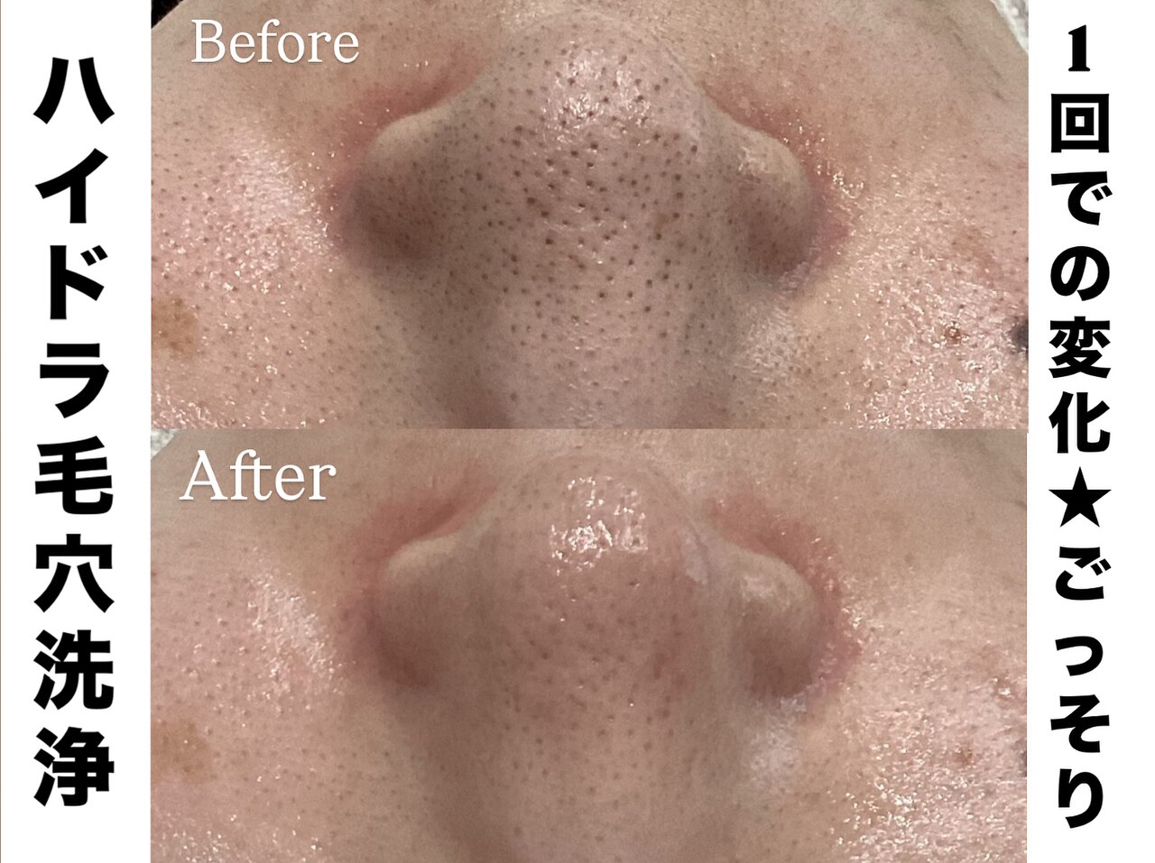 リンフェイス 表参道(RIN FACE)｜ホットペッパービューティー