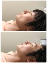 吉川美南ライフ整骨院/30代男性