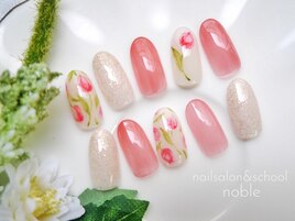 チップサンプル