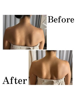 リプロ(RE:PRO)/小顔&肩こりコース