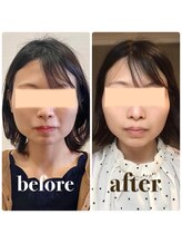 クリーム 京都店(Cream)/エラもキュッと