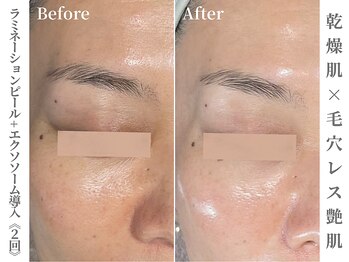 ゼアー(THERE FY.)/40代のエイジングサインに