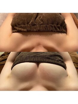 ラヴィス(ravis)/デコルテからボリュームアップ!