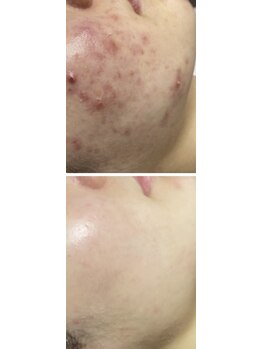 チュチュ(TUTU)/継続