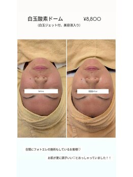 クレール 小山店(CLAIR)/【美白・鎮静・エンジングケア】