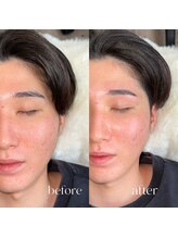 ランド(LAND)/【メンズ】眉毛wax