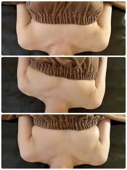 マホラ 本店(Mahora)/あなたの肩は大丈夫？