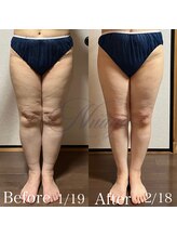 ニュアージュ(Nuage)/40代女性　1ヶ月の変化