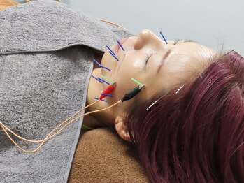 ムイ(mui)/美容鍼☆