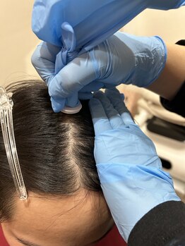 クラティス(CRATIS)/産後の育毛、髪質改善