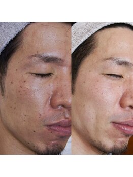 エトル(etole)/30代お客様症例写真