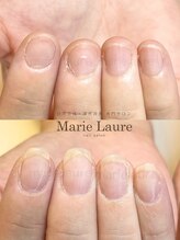 マリーロール 梅田店(Marie Laure)/深爪矯正/自爪育成/自爪風