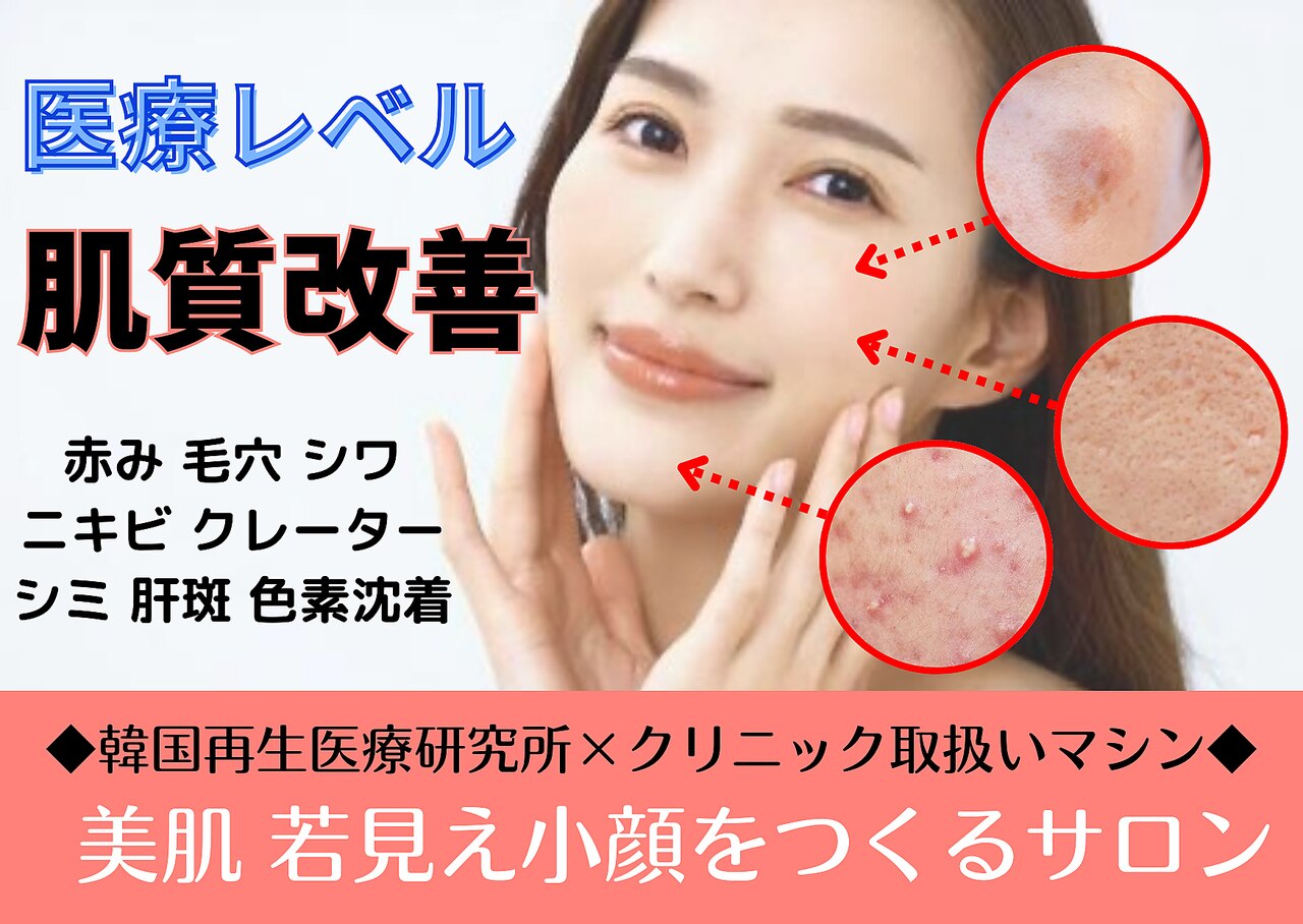 cocoro様 trim_fce_item670795cb8f5db.jpg