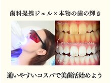 ホワイトニングショップ 多摩店/【ホワイトニング★40分照射】