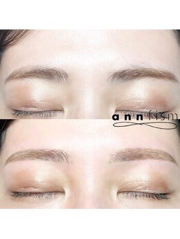 アンフィズム(annfism)/