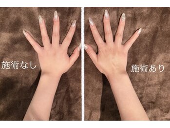 ディベス 仙台卸町本店(DIVES)/手の施術