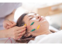 女性鍼灸師による美容鍼専門店 shika. 【 肩こり/小顔/たるみ/ほうれい線/シワ改善】の雰囲気（【美容鍼】お顔のこわばりをゆるめ、めぐりのよい健やかな肌へ）