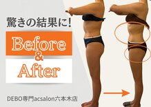 エーシーサロン 六本木店(acsalon)