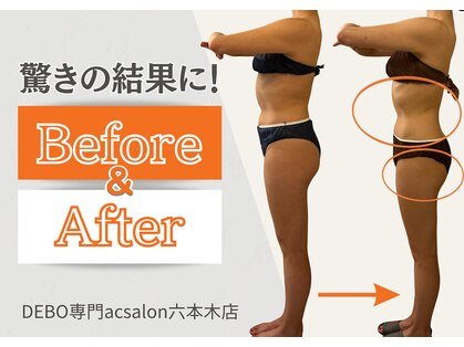 エーシーサロン 六本木店(acsalon)の写真