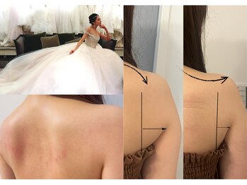 美温(mion)の写真/経験豊富な技で掘り出し肩甲骨で綺麗な天使の羽を！ブライダル痩身で理想な全身ケアが叶う♪
