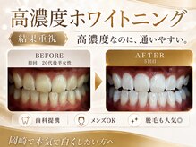 エクシアホワイトニング 岡崎店