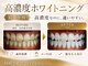 エクシアホワイトニング 岡崎店の写真