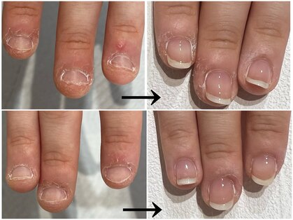 ネイルサロン ルレーヴ(Nail Salon le reve)の写真