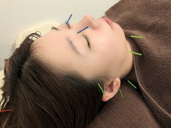 コンディショニングサロン クーラ(CURA)/美容鍼灸