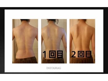 アレーズファイブフォー(A’LAISE54)/ボディケアハーブピーリング