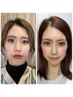 【人気No.2】戻らない小顔矯正×デコルテ矯正